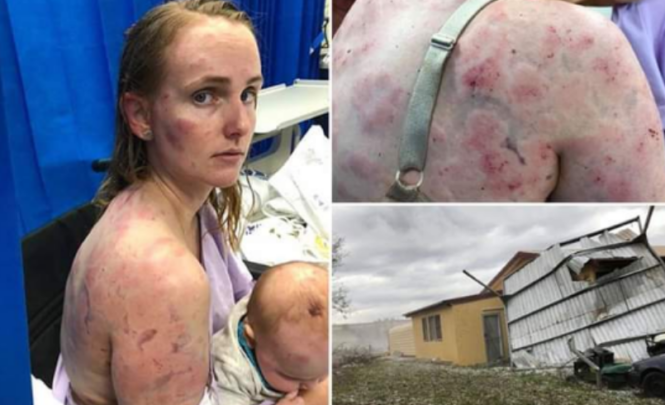 Majka heroj: Svojim tijelom zaštitila bebu od leda i oluje