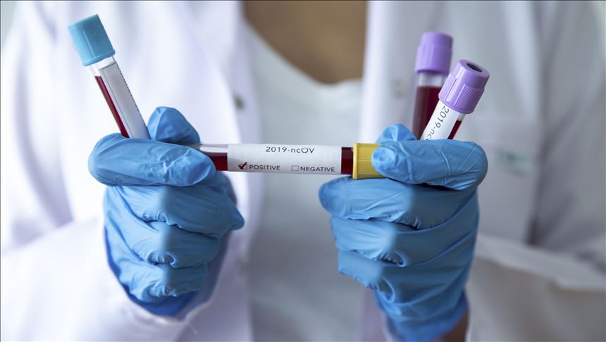 Dobre vijesti: U još jednom bh. gradu počeo s radom aparat za serološka testiranja