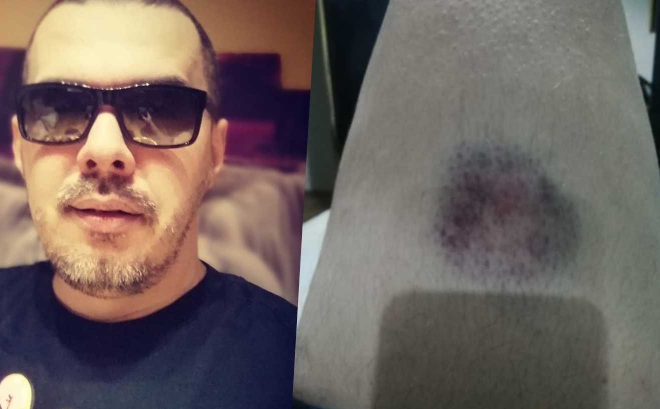 Pjevač tvrdi da jeu Neumu pretučen zbog pjesme “Bosanac”?: “Ne valja vam pjesma, ovo nije Bosna, tjerajte se odakle ste došli”